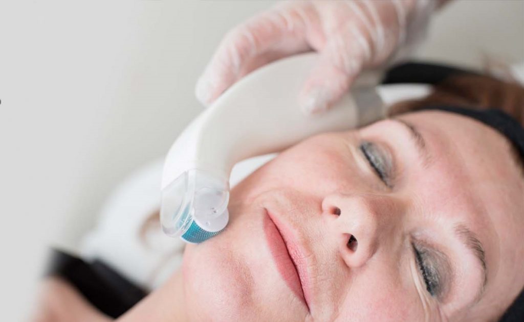 comcit microchanneling roller - beauty treatment